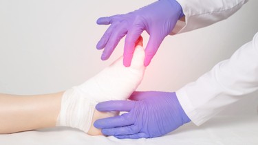 Trật khớp ngón chân: Nhận biết sớm và hướng dẫn điều trị tại nhà