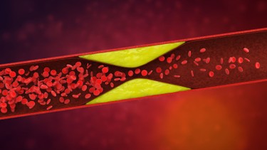 Triglyceride và cholesterol toàn phần: Hai chỉ số quan trọng cho sức khỏe tim mạch