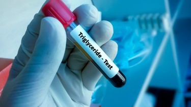 Triglycerides trong xét nghiệm máu là gì? Tại sao chỉ số này quan trọng với sức khỏe tim mạch?
