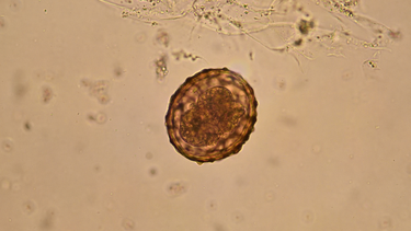 Trứng giun đũa là gì? Đặc điểm và chu kỳ phát triển