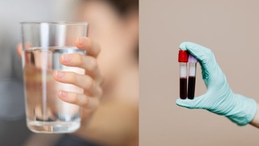 Trước khi xét nghiệm máu có được uống nước không? Những điều cần chuẩn bị