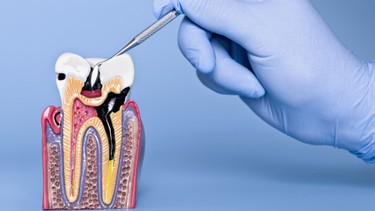 Tủy răng là gì? Cấu tạo, chức năng và những vấn đề thường gặp