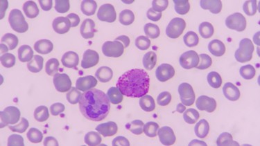 Tỷ lệ bạch cầu ái kiềm tăng: Ý nghĩa xét nghiệm và những vấn đề cần lưu ý