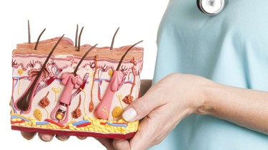 U tuyến bã nhờn: Tình trạng thường gặp nhưng ít ai hiểu rõ