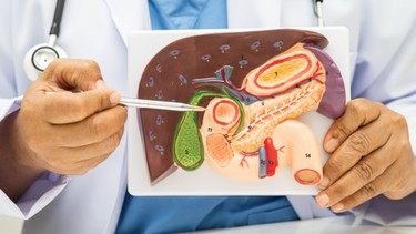 Ung thư tuyến tụy di căn: Những điều bạn cần biết