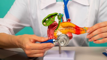 Ung thư tuyến tụy giai đoạn 4 là gì? Tiên lượng và các phương pháp điều trị hỗ trợ