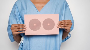 Ung thư vú xảy ra ở độ tuổi nào? Các yếu tố làm tăng nguy cơ mắc bệnh