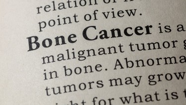 Ung thư xương giai đoạn cuối: Tiên lượng sống và hướng chăm sóc hiệu quả