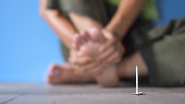 Uốn ván cục bộ là gì? Nhận biết sớm để phòng biến chứng nguy hiểm