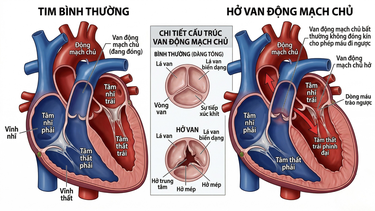 Van động mạch phổi: Cấu tạo, chức năng và các bệnh lý cần biết