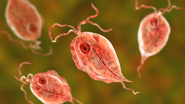 Viêm âm đạo do Trichomonas: Nguyên nhân, triệu chứng và cách điều trị