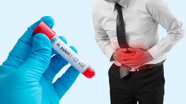 Viêm dạ dày HP: Nguyên nhân, chẩn đoán, điều trị và phòng ngừa