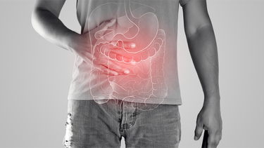 Viêm đại tràng là gì? Triệu chứng, chẩn đoán, điều trị và phòng ngừa
