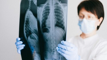 Viêm đường hô hấp dưới là gì? Nguyên nhân, triệu chứng và cách điều trị