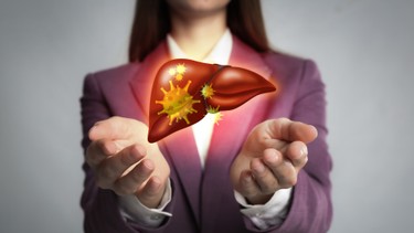 Viêm gan tự miễn sống được bao lâu nếu điều trị đúng?