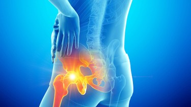 Viêm khớp cùng chậu có chữa khỏi được không và cách phòng ngừa