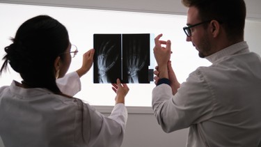 Viêm khớp dạng thấp có chữa khỏi được không? Các yếu tố hỗ trợ quan trọng ngoài thuốc