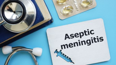 Viêm màng não nước trong: Dấu hiệu, nguyên nhân và cách điều trị hiệu quả