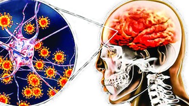 Viêm não Nhật Bản lây qua đường nào? Triệu chứng và biến chứng của bệnh