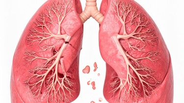 Viêm tiểu phế quản tắc nghẽn: Dấu hiệu, nguyên nhân và cách điều trị