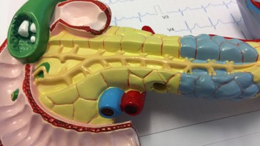 Viêm túi mật cấp do sỏi: Nguyên nhân và cách điều trị