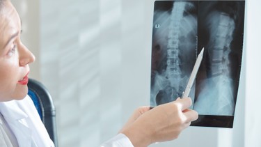 X-quang cột sống thắt lưng là gì? Khi nào cần chụp và cần lưu ý gì?