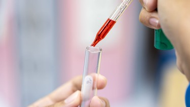 Xét nghiệm amylase là gì? Ý nghĩa và khi nào cần thực hiện?