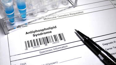Xét nghiệm Antiphospholipid và những điều bạn cần biết