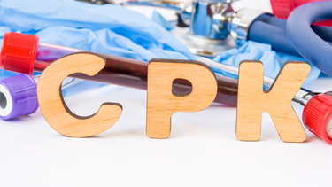 Xét nghiệm CPK là gì? Nồng độ CPK cao hơn bình thường cho thấy điều gì?