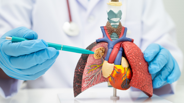 Xét nghiệm đột biến gen ung thư phổi là gì và ai nên thực hiện?
