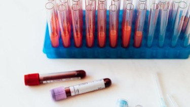 Xét nghiệm Double test hết bao nhiêu tiền? Chi phí và những điều cần biết