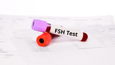 Xét nghiệm FSH là gì? Khi nào cần thực hiện xét nghiệm FSH?