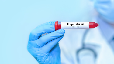 Xét nghiệm HAV là gì? Một số xét nghiệm HAV phổ biến