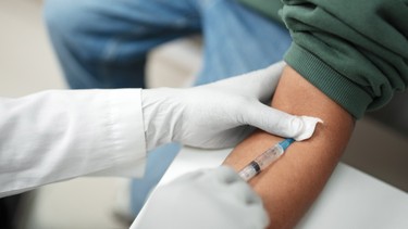 Xét nghiệm HBV DNA là gì? Được chỉ định khi nào?