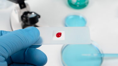 Xét nghiệm HIV Combi PT: Khi nào nên làm và cách hiểu kết quả xét nghiệm