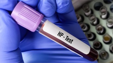 Xét nghiệm HP là gì? Các phương pháp xét nghiệm HP và những điều cần biết