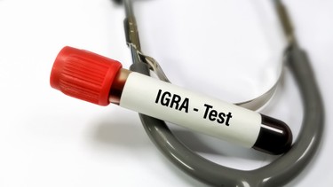Xét nghiệm IGRA: Ý nghĩa, quy trình và những điều cần biết
