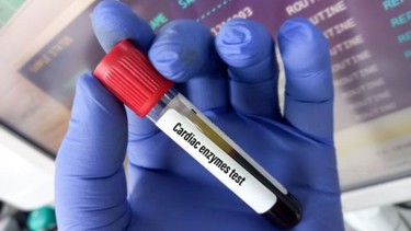 Xét nghiệm men tim​ là gì? Khi nào cần xét nghiệm?