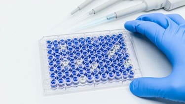 Xét nghiệm miễn dịch: Các loại xét nghiệm và lưu ý khi thực hiện