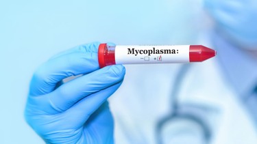 Xét nghiệm Mycoplasma là gì? Những điều bạn cần biết