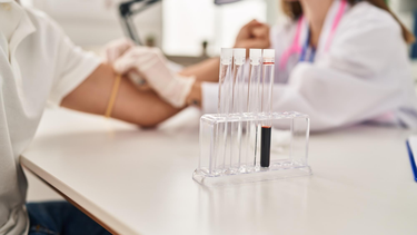 Xét nghiệm NAT là gì? Ưu điểm và hạn chế cần lưu ý