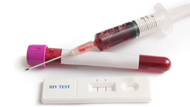 Xét nghiệm nhanh HIV là gì? Ưu điểm, nhược điểm