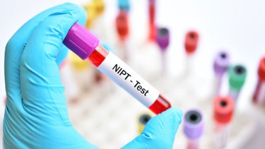 Xét nghiệm nipt giá bao nhiêu tiền? Có đắt không?