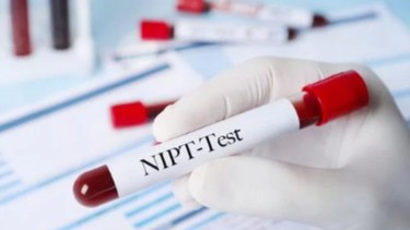 Mẹ bầu nên thực hiện xét nghiệm NIPT từ tuần thứ mấy là chính xác nhất?