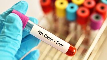 Xét nghiệm NK trước chuyển phôi là gì? Vai trò của tế bào NK trong quá trình làm tổ của phôi