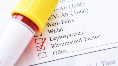 Xét nghiệm RF là gì? Khi nào cần thực hiện?