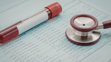 Xét nghiệm TCK là gì? Vai trò trong rối loạn đông máu