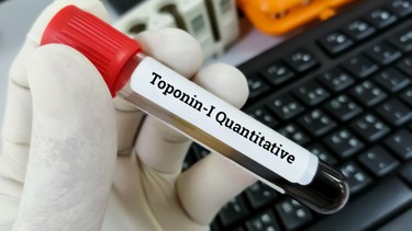 Xét nghiệm Troponin T là gì? Khi nào cần thực hiện xét nghiệm Troponin T?