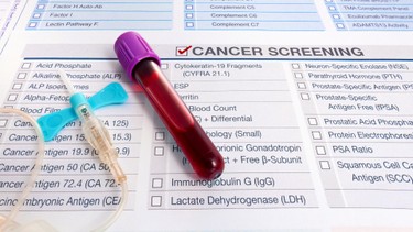 Xét nghiệm ung thư gồm những gì và quy trình ra sao?