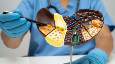 Xơ gan F4 có chữa được không? Tiên lượng và cách phòng ngừa